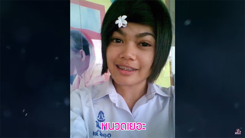 พิมรี่พาย ศัลยกรรม