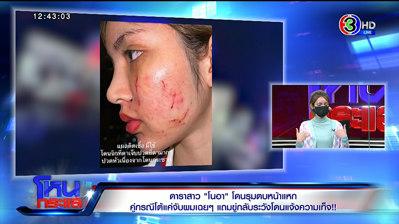 โนอา ภญมน ถูกตบหน้าพังเป็นหนอง