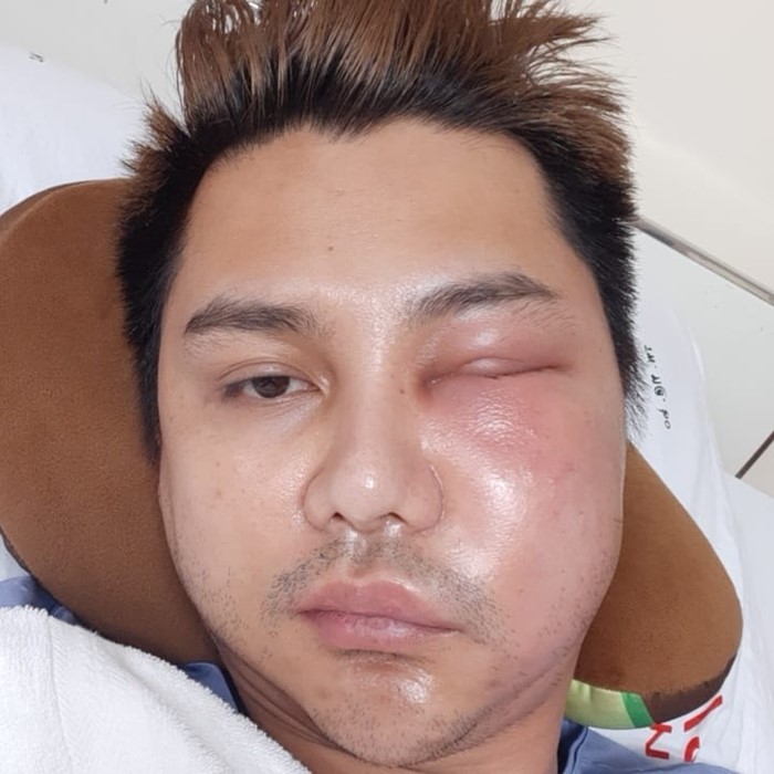 วิว ชัชวาล อาร์สยาม