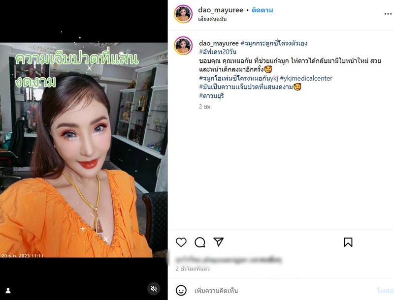 ดาว มยุรีย์