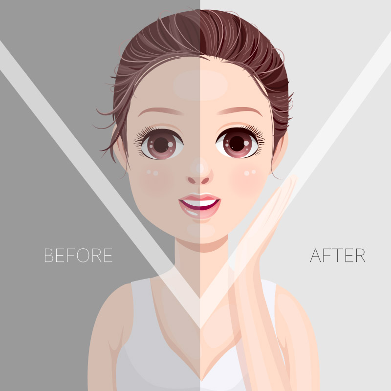 วิธีลดแก้ม, ลดเหนียง