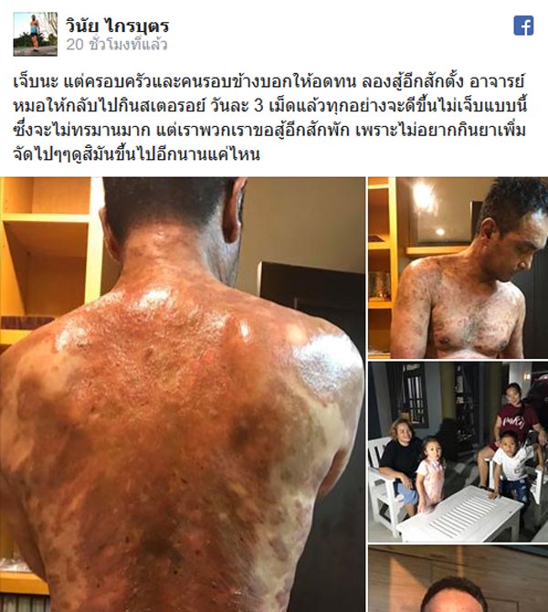 เมฆ วินัย ไกรบุตร