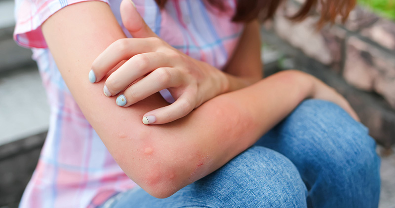 น้ำเหลืองไม่ดี