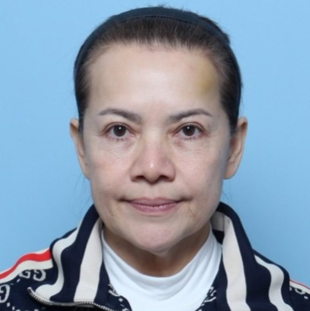 ส่องภาพก่อน-หลังศัลยกรรม หนูแหม่ม สุริวิภา ในวัย 58 สวยเป๊ะย้อนวัยสุด ๆ