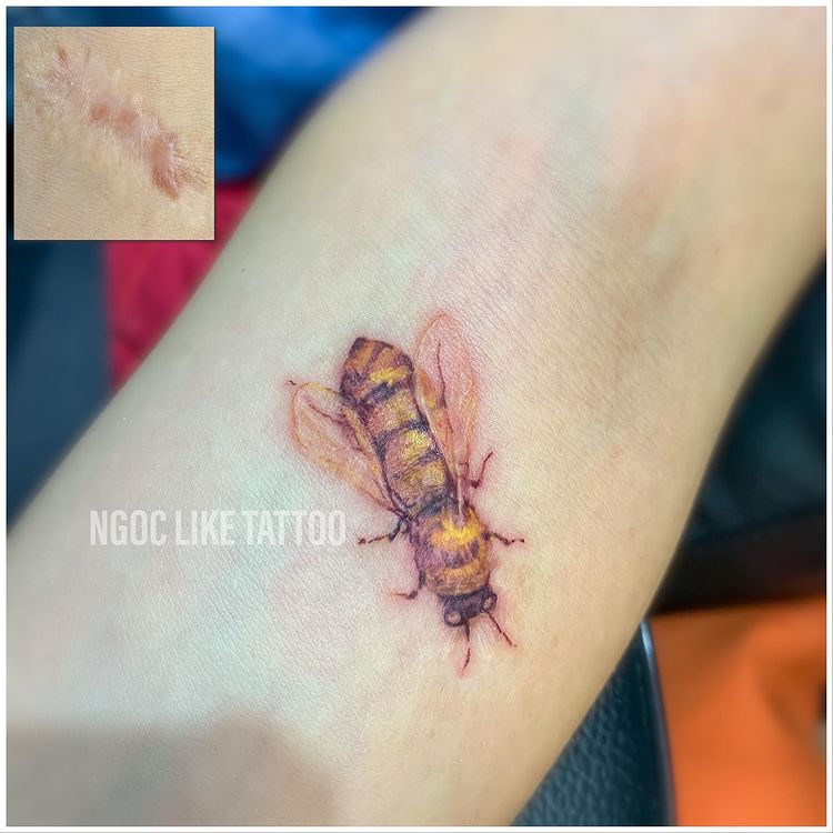 รอยสักจากรอยแผลเป็น