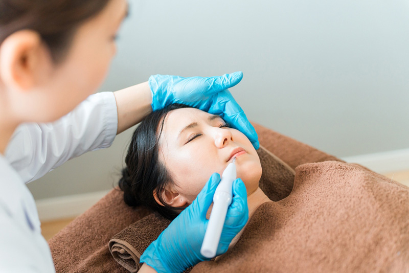 ขอบปากคล้ำ