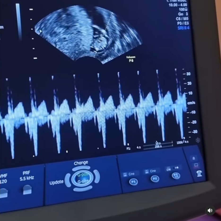 ชมพู่ อารยา