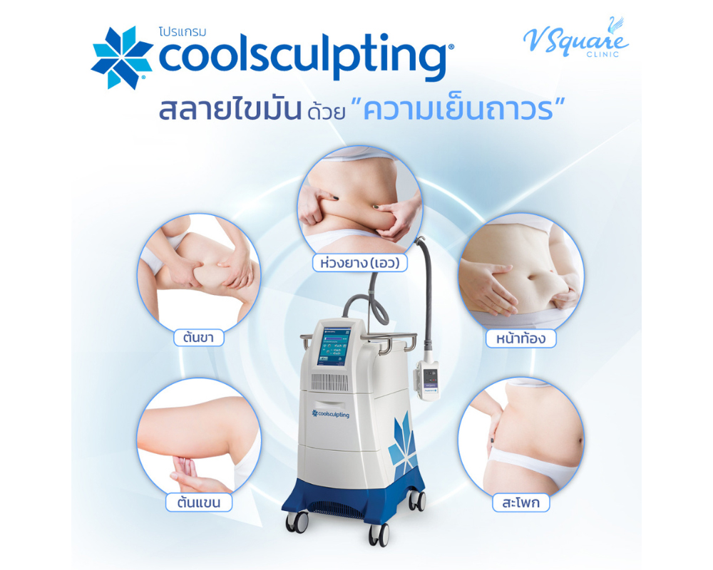 ตำแหน่งทำสลายไขมันด้วยความเย็น