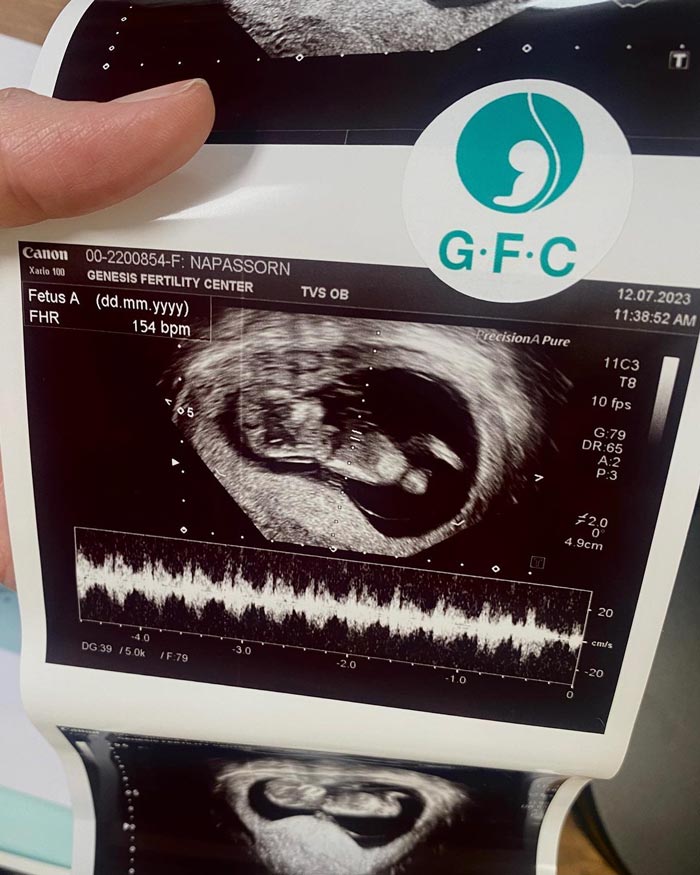 เป๊ก เปรมณัช นิว นภัสสร