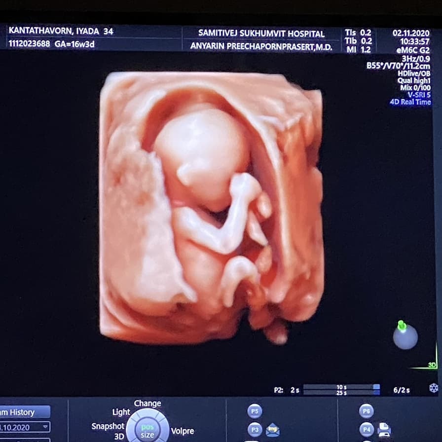 พลอย อัยดา , กันต์ กันตถาวร