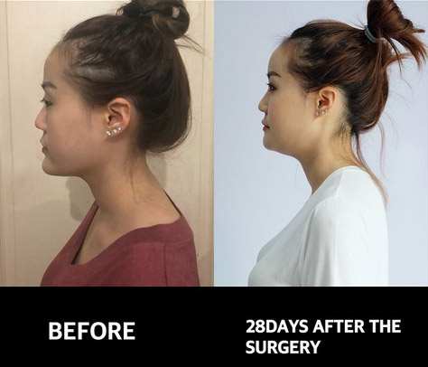 พัฒนาการความสวย