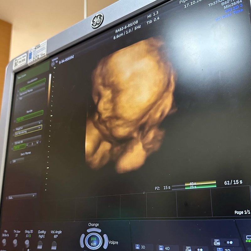 บุ๋ม ปนัดดา