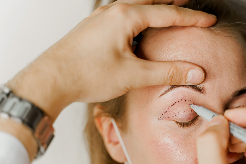 ศัลยกรรม