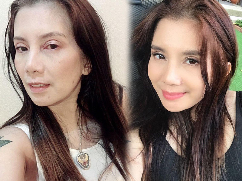 ดาราศัลยกรรม