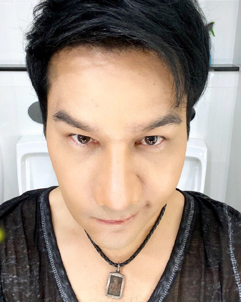 กอล์ฟ เบญจพล ศัลยกรรม