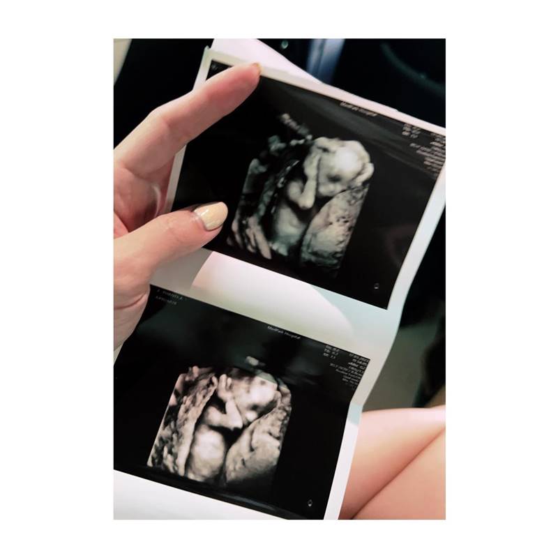 แอร์ ภัณฑิลา ท้อง