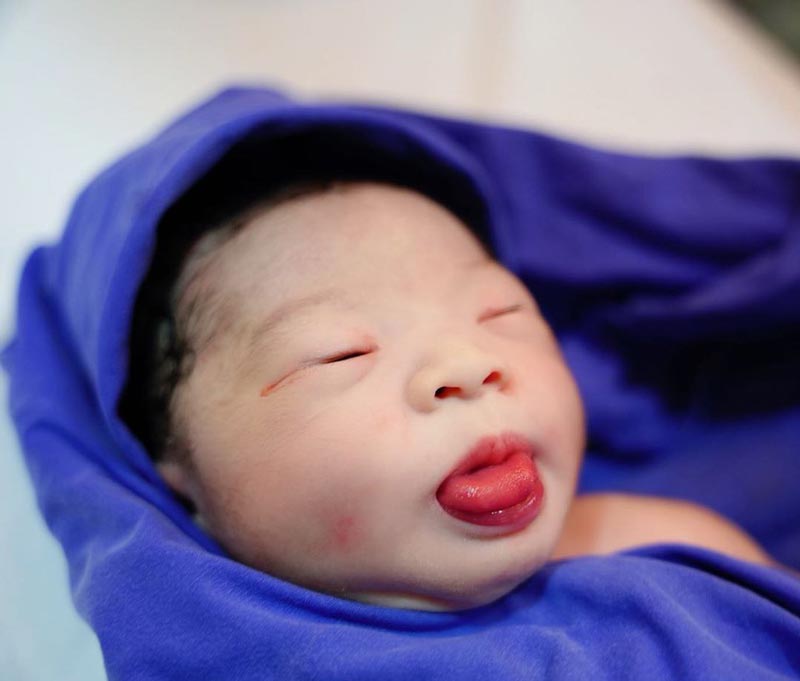 กุ๊บกิ๊บ คลอดลูก