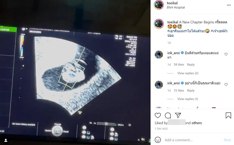 เตย เพิร์ท