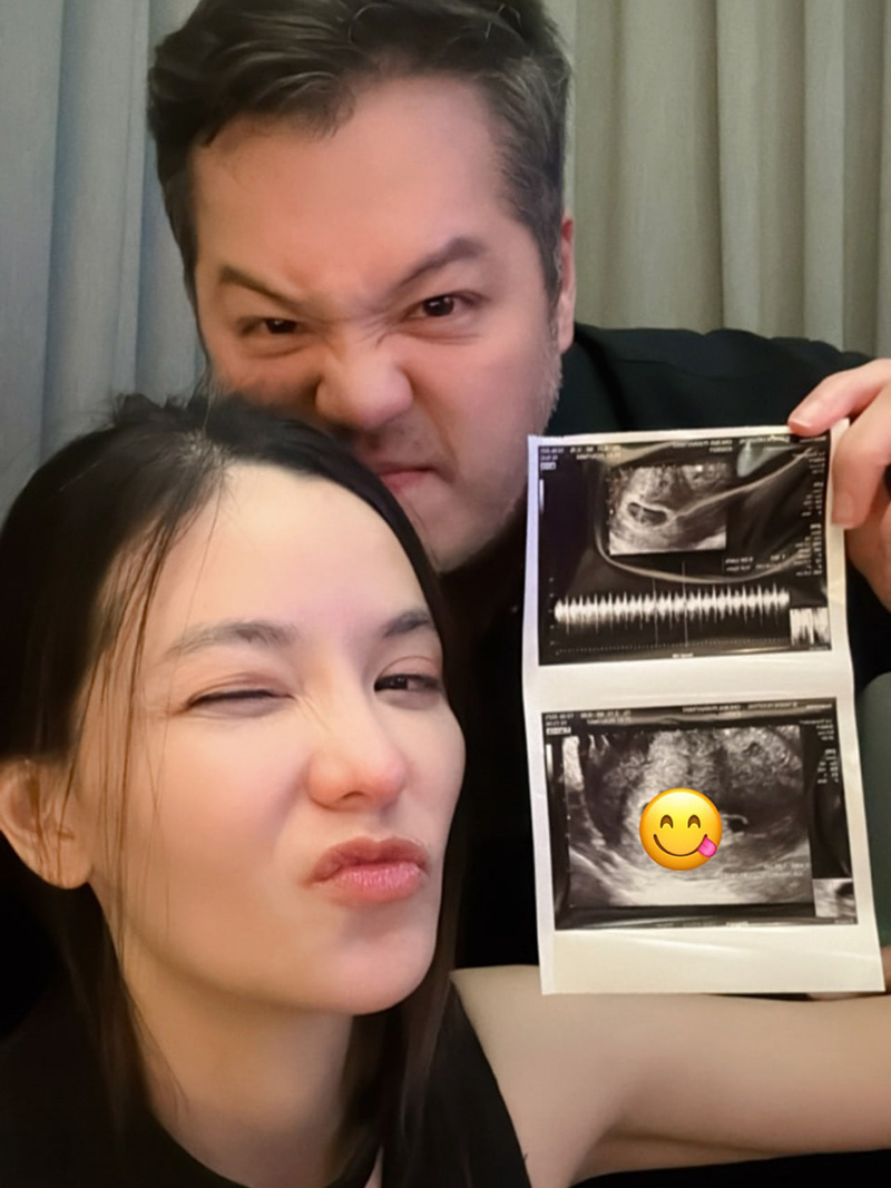 หมออร ประกาศท้องแล้ว เกรท วรินทร