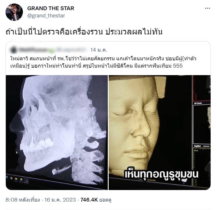 ใหม่ ดาวิกา สแกนหน้า โชว์ไม่ได้ศัลยกรรม