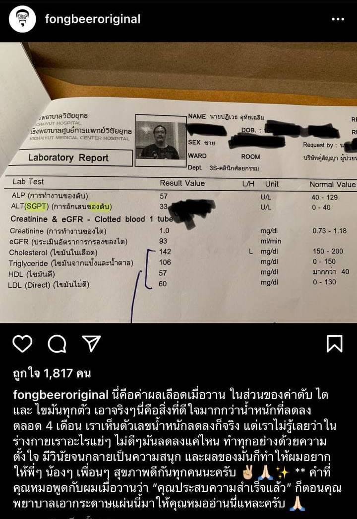 ฟองเบียร์ ผอม