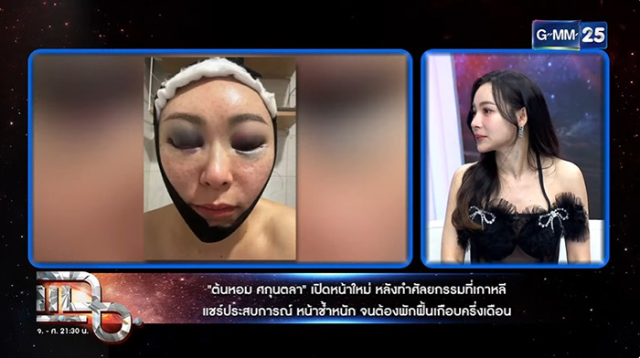 ต้นหอม ศกุลตลา