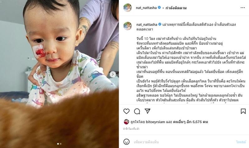 ลูกแนท ณัฐชา โดนหมากัดหน้า