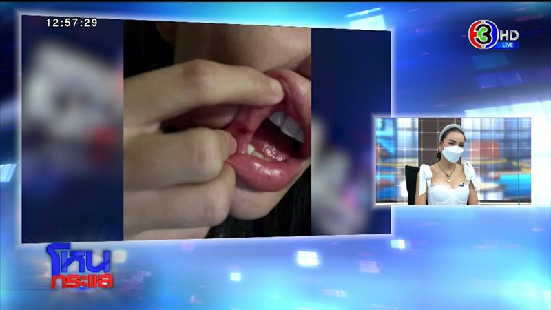 เติ้ล นิวนิว โหนกระแส