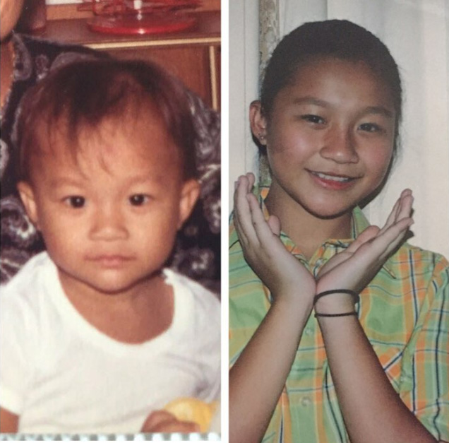 เอ็ม บุษราคัม ดาราศัลยกรรม