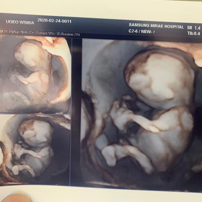 ลูกอ้วน รังสิต