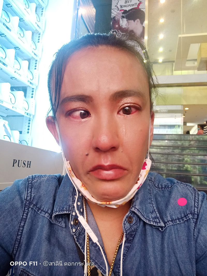 ตาหวาน ดอกกระโดน 