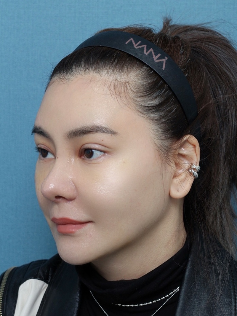 โอ๋ ภัคจีรา