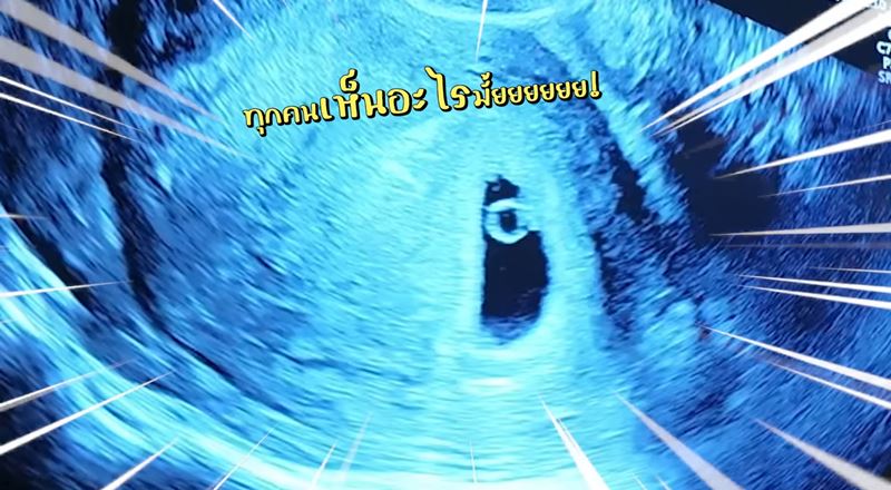 แพทตี้ อังศุมาลิน