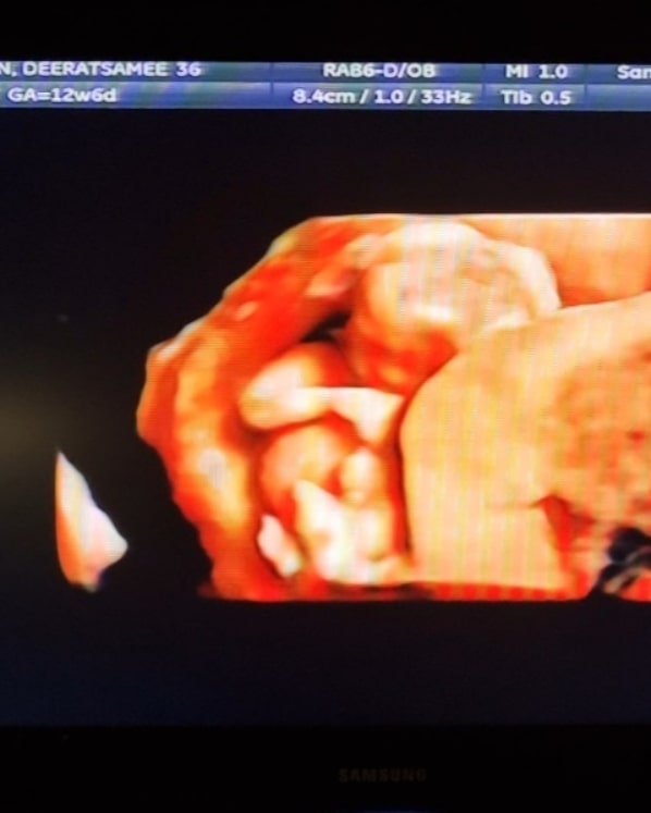 แนนนี่ เกิร์ลลี่เบอร์รี่