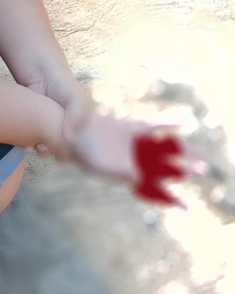 ประทัดกระเทียม