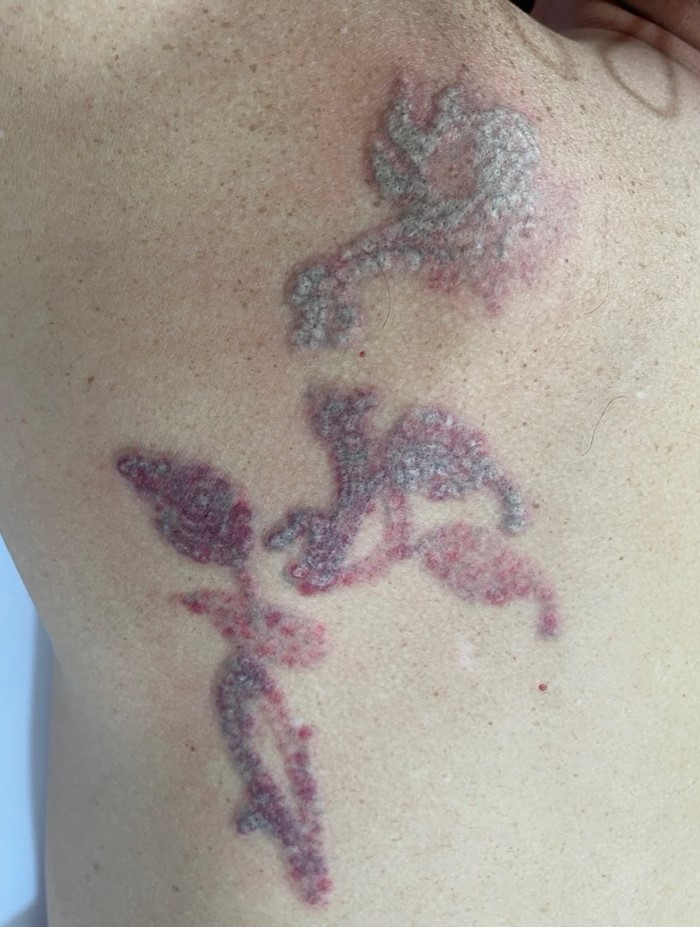 อั๋น โอลิเวอร์ 