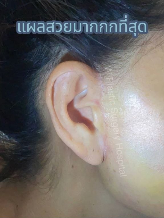 นก สินจัย