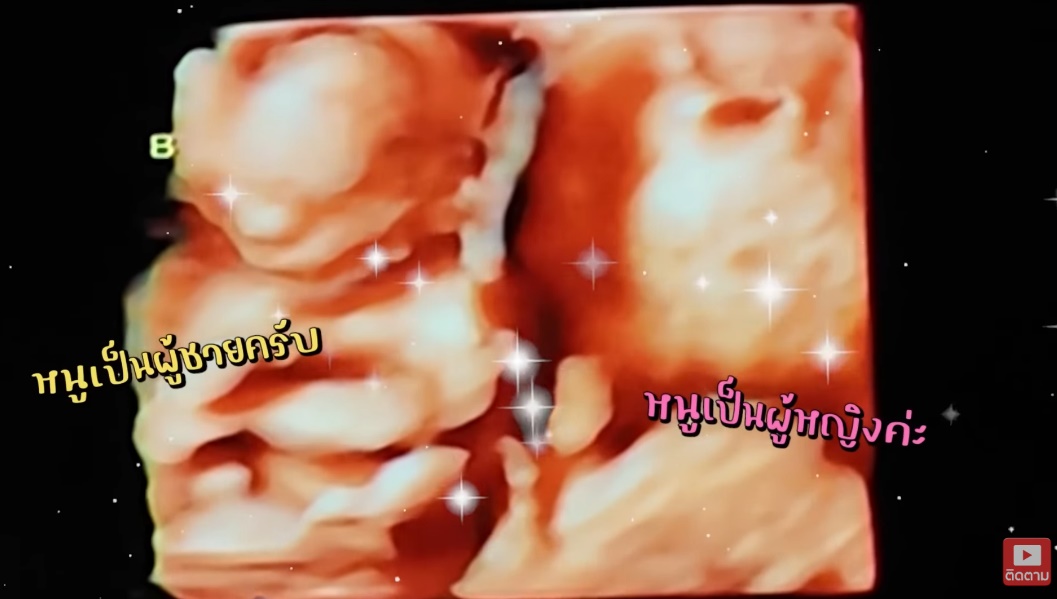 แดน แพทตี้