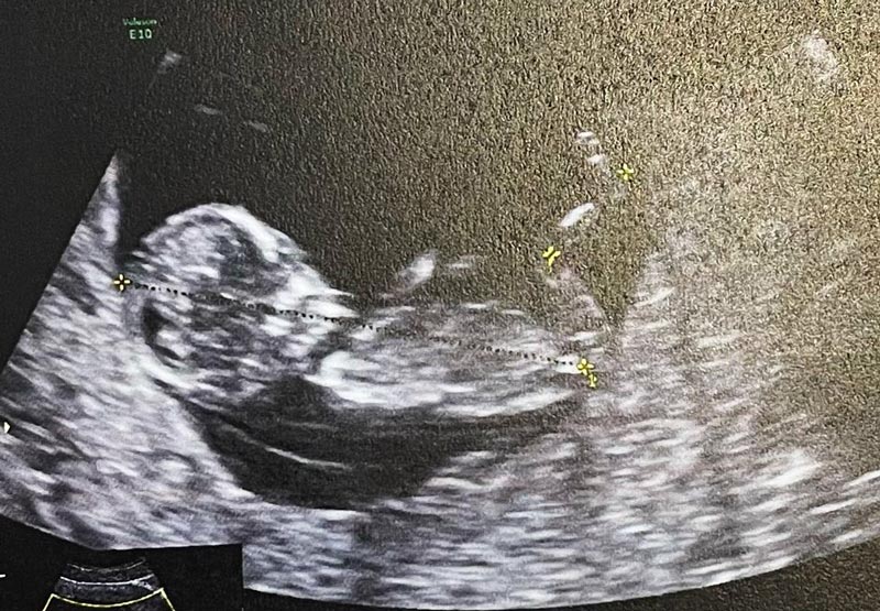 น้ำชา ดร.วาว