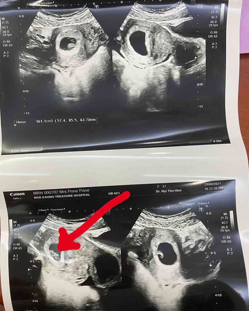 ลูกแก้ว ศรีกานต์