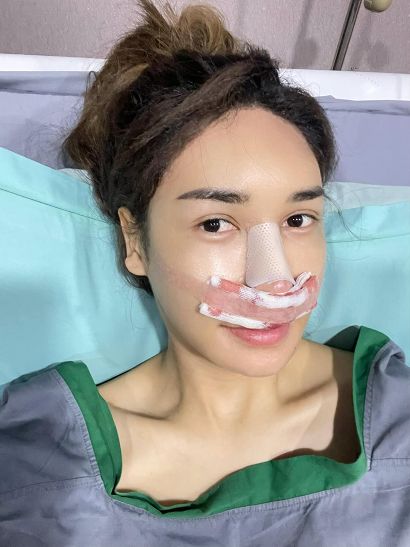 บาสตี้ เน็ตไอดอลสาวสอง