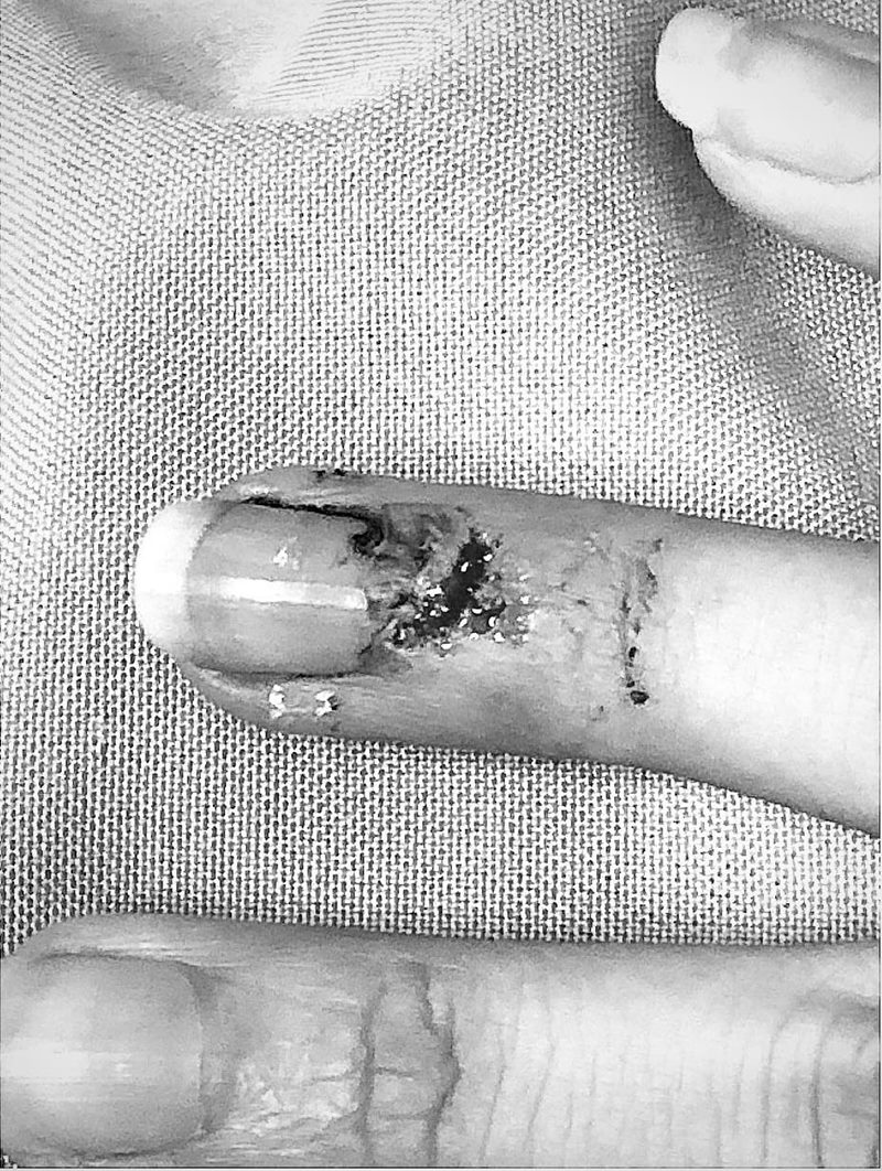 เบลล่า ราณี