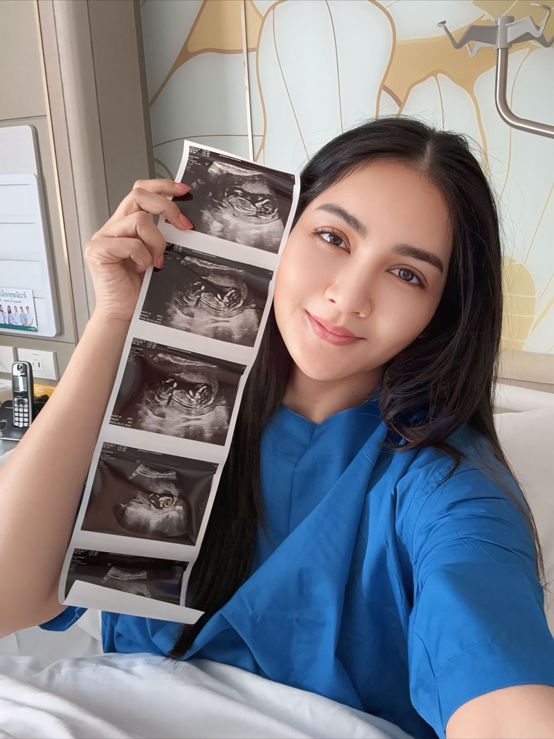 ครูก้อย ภรรยาเจมส์ เรืองศักดิ์ เย็บปากมดลูก ป้องกันคลอดก่อนกำหนด