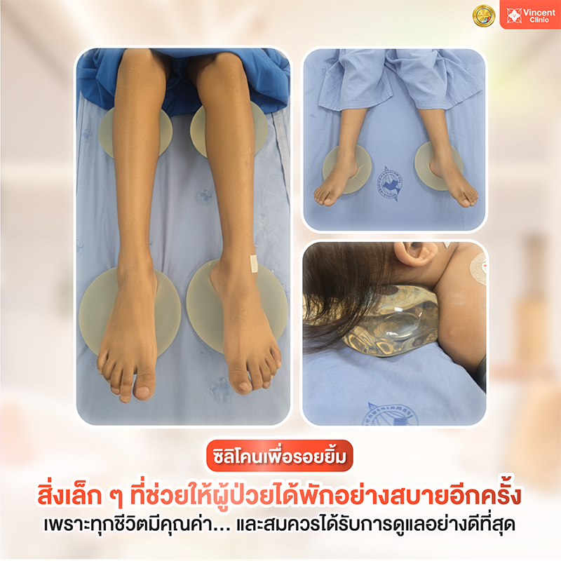 Vincent Clinic มอบซิลิโคน