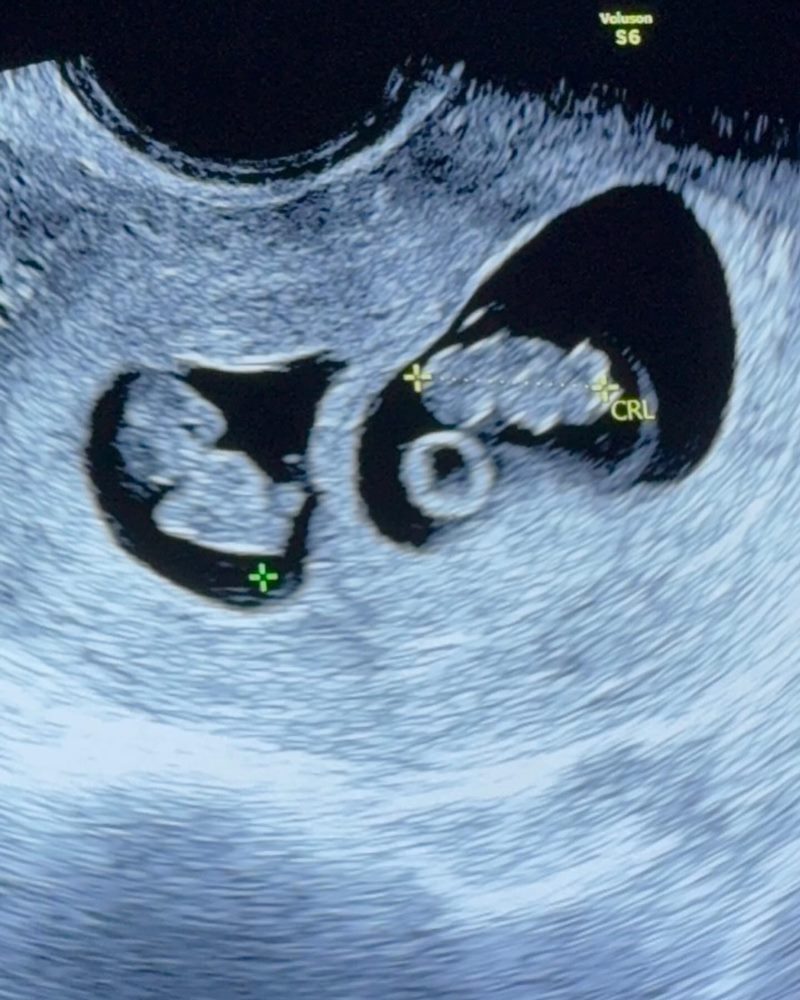 ออย นันทิสา