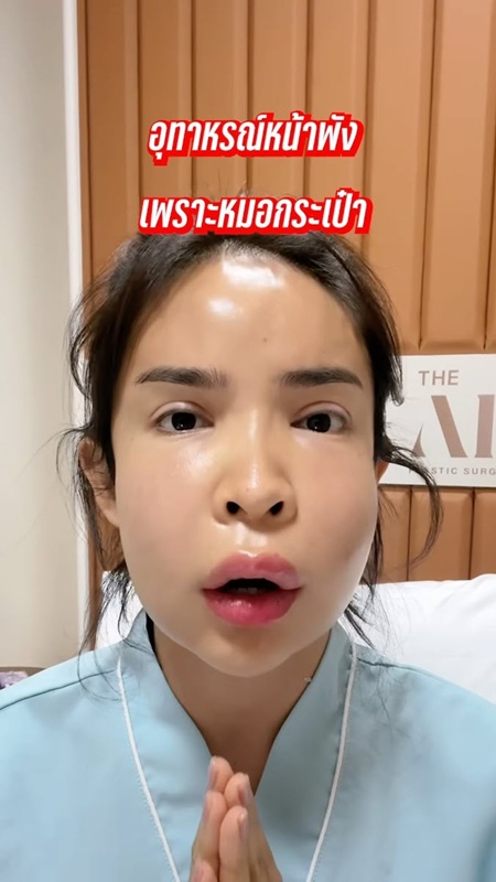 นัท นิสามณี หน้าบวมจนจำไม่ได้