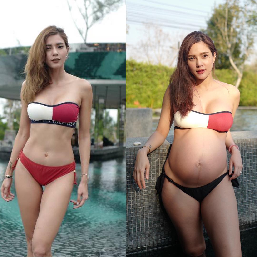 อุ้ม ลักขณา