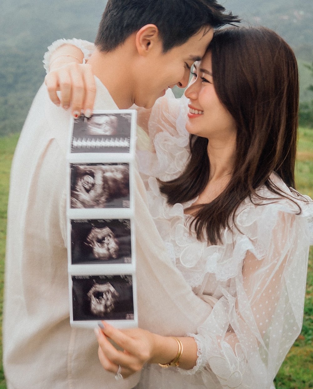 เจมส์ จิรายุ อวดภาพอัลตราซาวด์ ประกาศข่าวดีรับวันแม่ ภรรยาท้องแล้ว