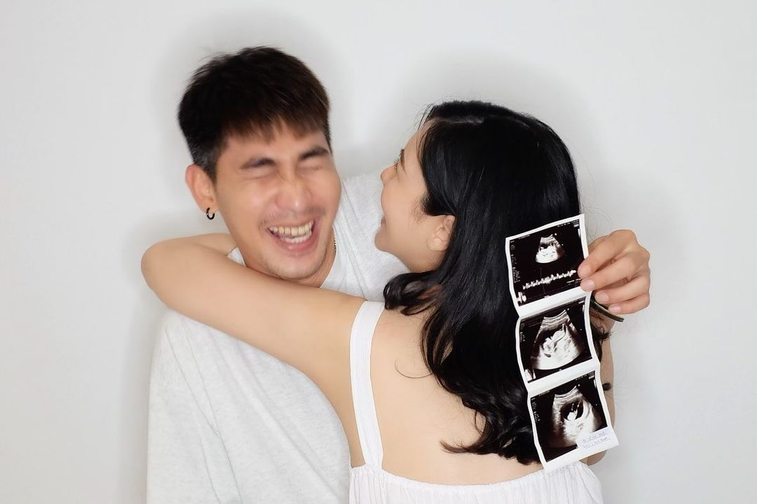  แก้ม กวินตรา