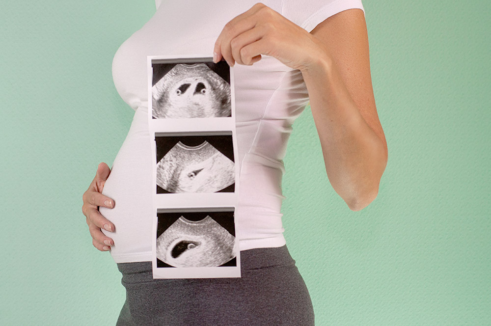 ตั้งครรภ์แฝด